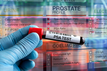 Blood tube test with requisition form for Prostate PSA test. Blood sample tube for analysis of Prostate PSA profile test in laboratory
