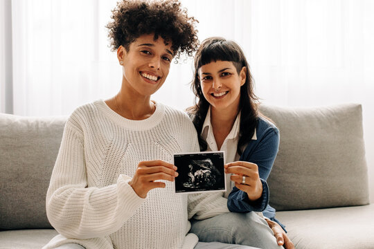 Married lesbian couple holding up an ultrasound picture of their