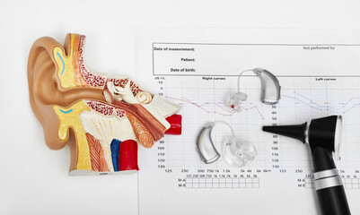 Hearing test concept. Result of hearing exam - audiogram, hearing aids and otoscope on audiologist...