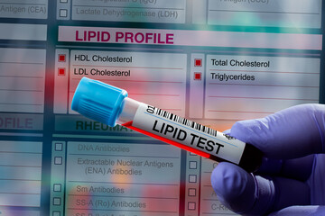 Blood tube test with requisition form for Lipid test. Blood sample tube for analysis of Lipid...