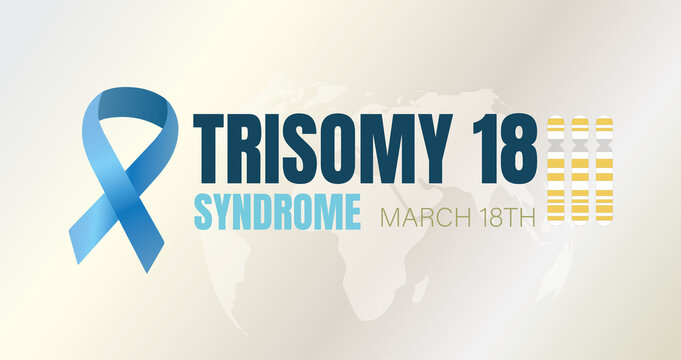 World Edwards' syndrome day. Autosomal abnormalities. Trisomy 18. Genetic disorder.