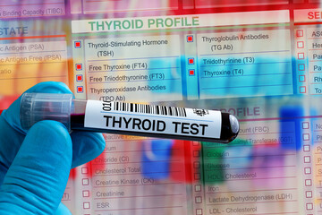 Blood tube test with requisition form for Thyroid hormone test. Blood sample tube for analysis of Thyroid hormone profile test in laboratory