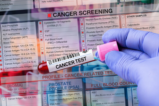 Blood tube test with requisition form for Cancer screening test. Blood sample tube for analysis of Cancer profile test in labor