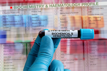 Blood tube test with requisition form for Biochemical and Hematology test. Blood sample tube for...
