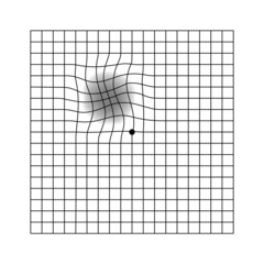 Amsler eye scotoma test grid. Vector printable chart retina examination. Grid with dot in centre. Vision control. Eye check amsler grid test
