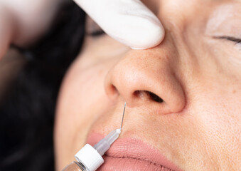 Female cosmetology in a beauty salon. Doctor nose tip correction and lifting.
