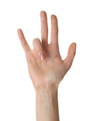 Fototapeta premium Woman with trigger finger condition on white background, closeup