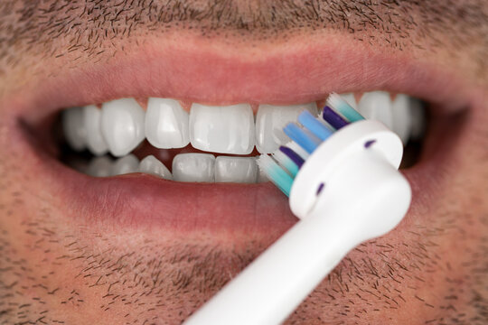 Z&auml;hne putzen mit elektrischer Zahnb&uuml;rste