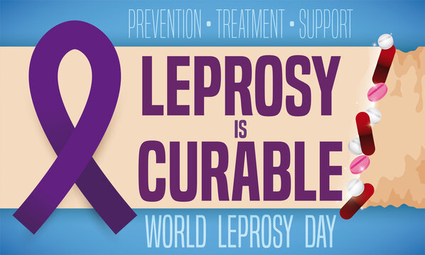 Purple Ribbon and Medication Cleaning Skin during World Leprosy Day, Vector Illustration