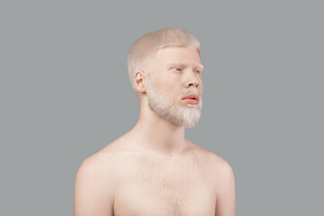 Skin abnormality concept. Albino guy posing without shirt and lookig aside on grey studio background