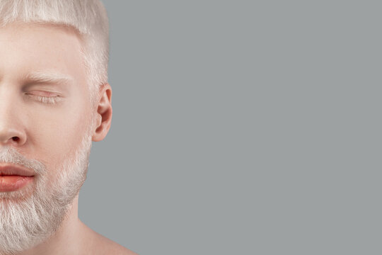 Half face portrait of young albino man with closed eyes, pale skin and white hair on grey studio background, free space