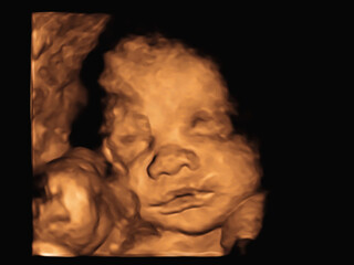 image Ultrasound 3D4D of baby in mother's womb.