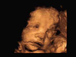 image Ultrasound 3D4D of baby in mother's womb.