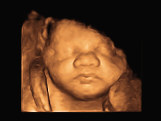 image Ultrasound 3D4D of baby in mother's womb.