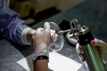 The doctor makes the patient cryotherapy procedure. Close-up of the patient's hand and wounded fingers.