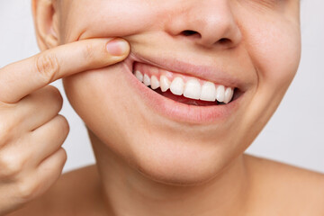 Gum health. Cropped shot of a young woman showing healthy gums. Dental care, dentistry concept - obrazy, fototapety, plakaty