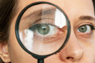 Close-up of woman's eye with red inflamed and dilated capillaries magnified with a magnifying...