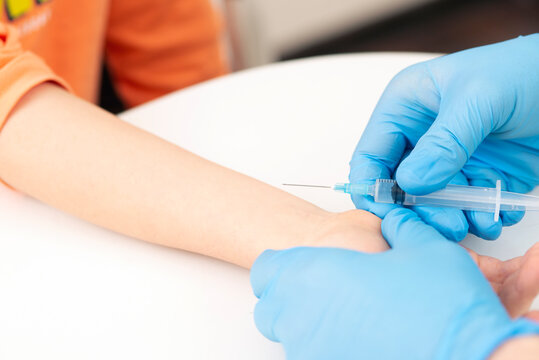 doctor pediatr conducts a Mantoux test for a child in a clinic. Hand and syringe close-up Medical hand. medicine pediatrician. Kid vaccine medical immunization. 