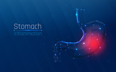 Abstract line and dot. Inflammation of the human stomach. urgent medical care. Low poly health care vector illustration. plexus, wireframe style. the medicine
