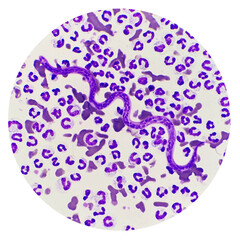 Microfilariae are not sheathed in the blood smear of a dog. Light microscope of heartworms,...