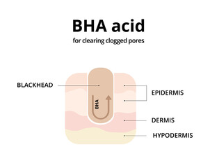 BHA acid for cleaning clogged pores. Removing blackheads, salicylic acid, oily skin. For topics like cosmetology, treatment, exfoliating