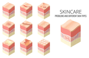 Skincare medical concept. Set of problems of different skin types in cross-section of human skin horizontal layers structure - obrazy, fototapety, plakaty