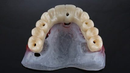 beautiful composition of the dental prosthesis of the upper jaw, view of the anatomy of the teeth on a black background © Dental Pro Content