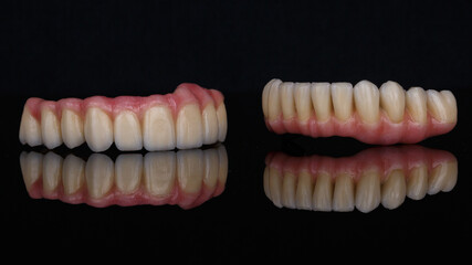 beautiful ceramic dental prostheses of the upper and lower jaws, filmed on black glass with creative reflection