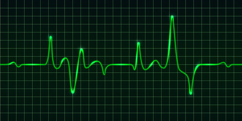 Heart beat pulse monitor, green electric wave signal, oscilloscope graph. Electrocardiogram line graph with light glow effect. Technology vVector illustration
