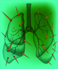 The illustration of lungs of cancer patients. This illustration can be used for medical and science materials. Vector illustration.