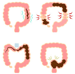 便秘　イラスト