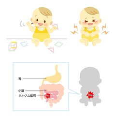 イラスト素材:マグネットパズルの破損で内蔵のネオジム磁石を幼児が誤飲し胃や腸に穴が開く事故
