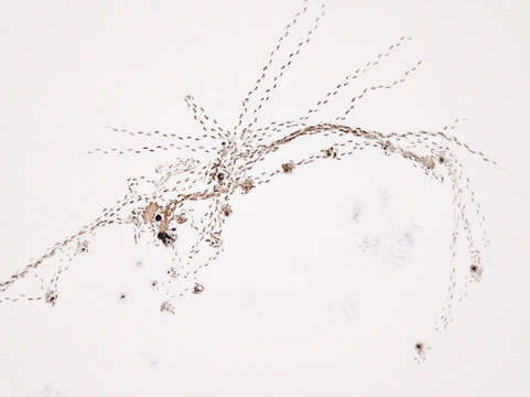 Aerial view of lone fisherman at frozen snow covered lake