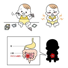 イラスト素材 マグネットパズルの破損で内蔵のネオジム磁石を幼児が誤飲する場面胃や腸に穴が開く事故 Abdominal Pain Poster Abdominal Pa Kuroshimaharu