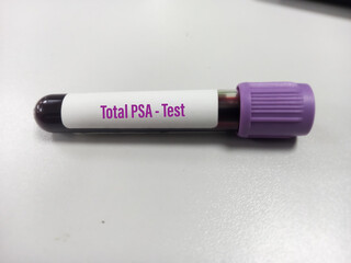 Blood test tube with sample for total PSA(Prostate specific antigen) test, diagnosis of prostate...