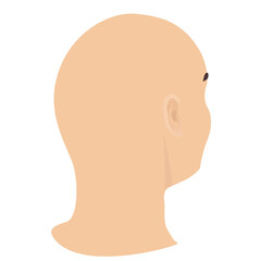 Bald head of a man in side view. Alopecia in men. Health care and beauty concept. Vector cartoon illustration