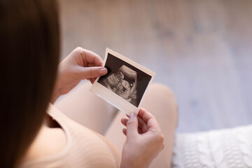 a pregnant girl holds in her hands a photo from an ultrasonic study of her unborn child