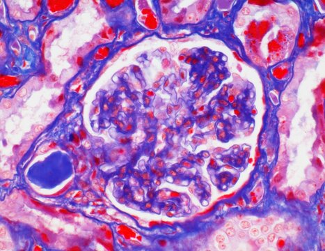 Glomerulus, LM