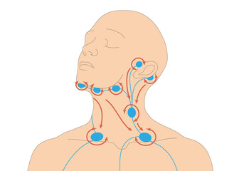 Infografik - Lymphdrainage am Menschen - Vorbehandlung am Hals