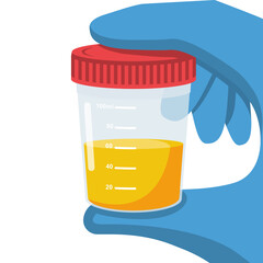 Urine analysis. The doctor in gloves holds jar with urine analysis. Test icon. Pee sample in plastic box. Medical sample in a glass tube. Laboratory container. Vector illustration flat cartoon design. - obrazy, fototapety, plakaty