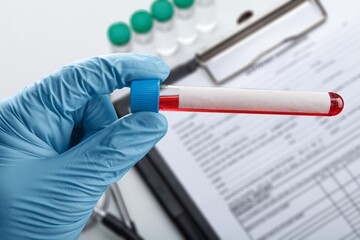 Blood sample for test at medical laboratory