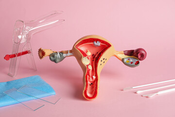 Gynecological examination kit and anatomical uterus model on pink background - obrazy, fototapety, plakaty