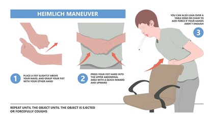 Choking first aid baby food CPR child step lodges blocking victim adult help abdomen kids conscious poster swallow back blows chest rescue breath care safety