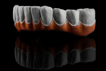 milled zircon dental prosthesis on black background with creative reflection