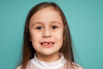 Cheerful cute child with teeth dropped out - preschooler girl with open mouth without milk tooth