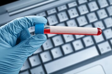 Blood sample tube on keyboard background