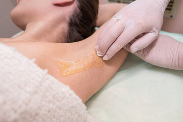 Cosmetology sugar hair removal of a female armpit in a spa center