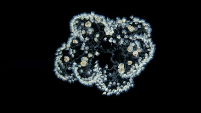 Infusoria Ciliophora Peritrichia under microscope, order Sessilida, class Oligohymenophorea. Drops when in danger. Indian Ocean. Possibly family Zoothamniidae
