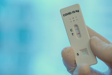 Virologist showing Positive Antigen Rapid Test for Coronavirus.
