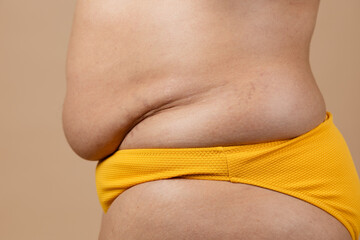 Cropped image of overweight fat pregnant woman sag stomach side view, excess fat in yellow pants....